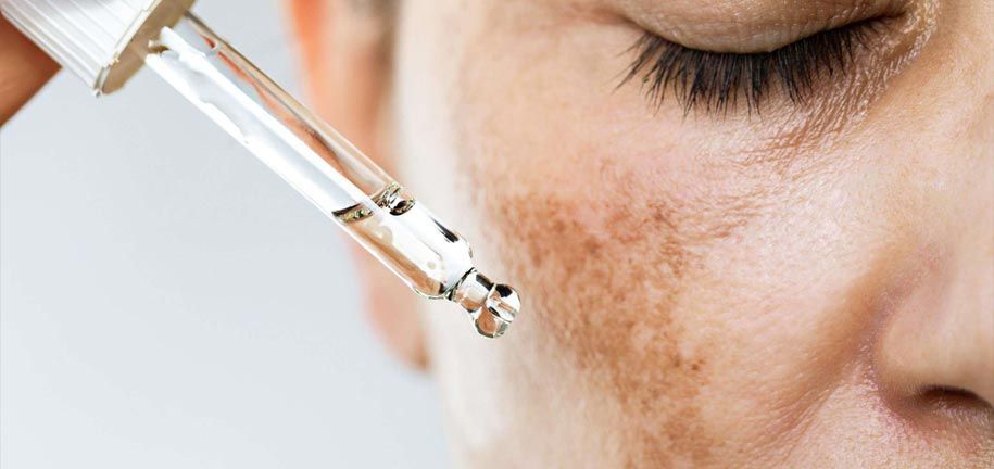 דרכים יעילות לטיפול בהיפרפיגמנטציה