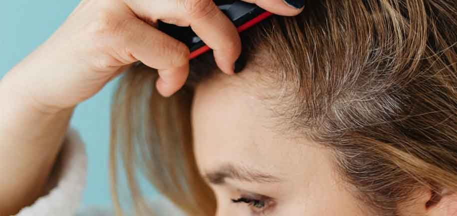 להיפטר מקשקשים