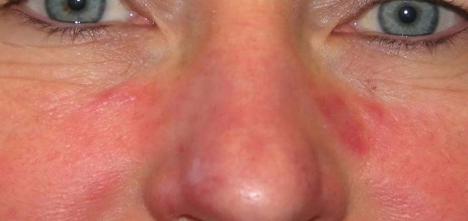 שגרת טיפוח לעור סבוראי