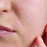 נקבוביות סתומות