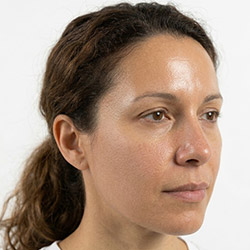 טיפוח לעור מעורב