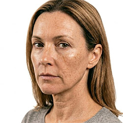 מוצרי טיפוח להבהרת העור