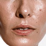 טיפוח לעור שמן