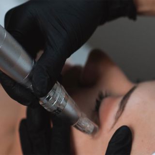 Eyes facial treatment