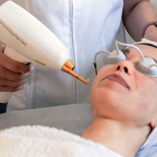Eyes facial treatment